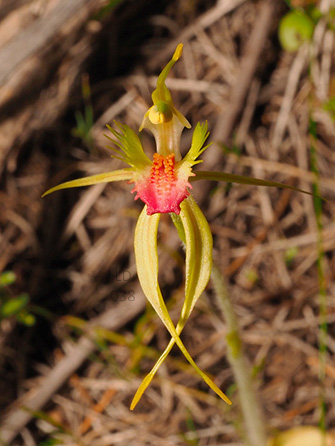 Microsoft Word - SAN Vol. 91, No. 1, Jan-Jun 2017  pp. 34-37 Orc